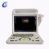 Portable Ultrasound